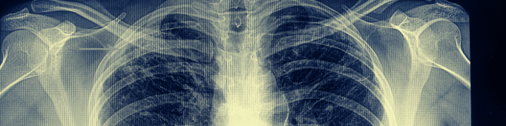 Pulmonary Monitoring